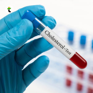 Tes Kolesterol