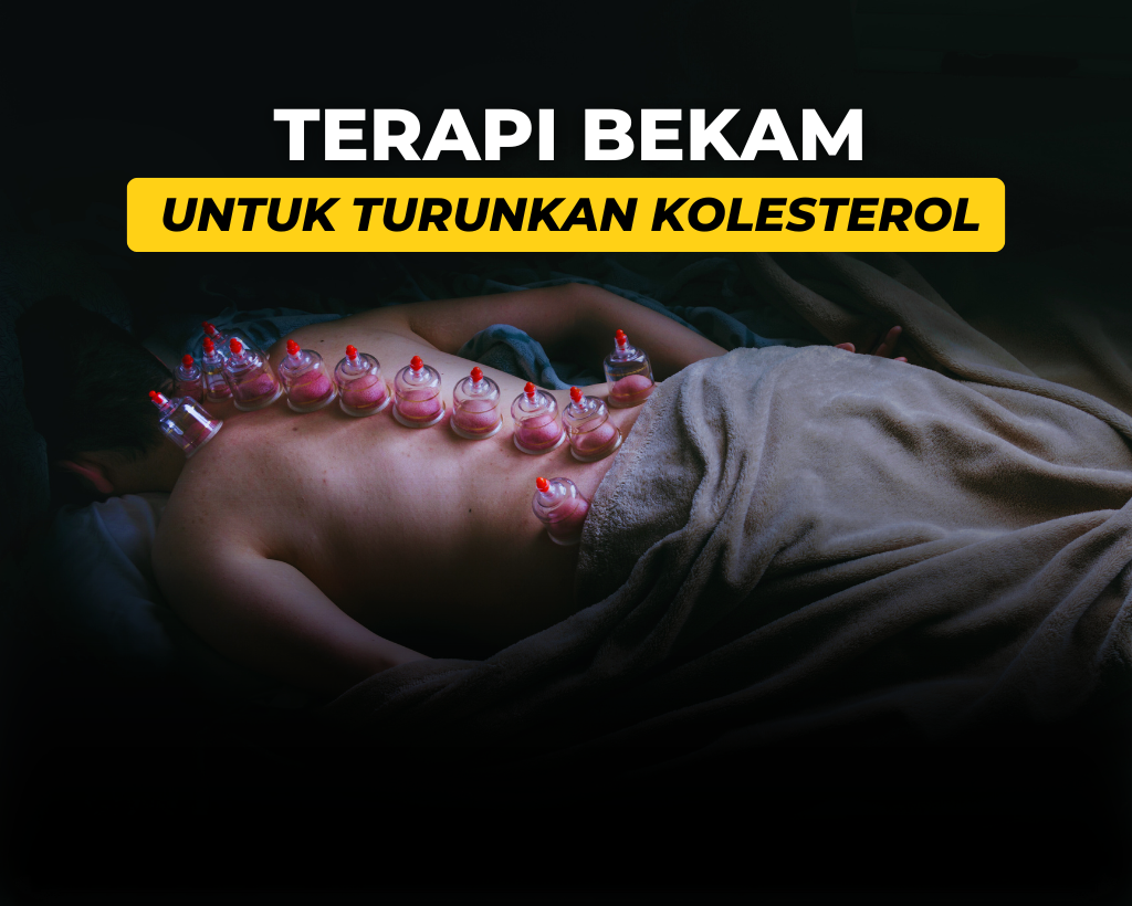 Kenali Tanda Darah Kolesterol yang Keluar saat Bekam